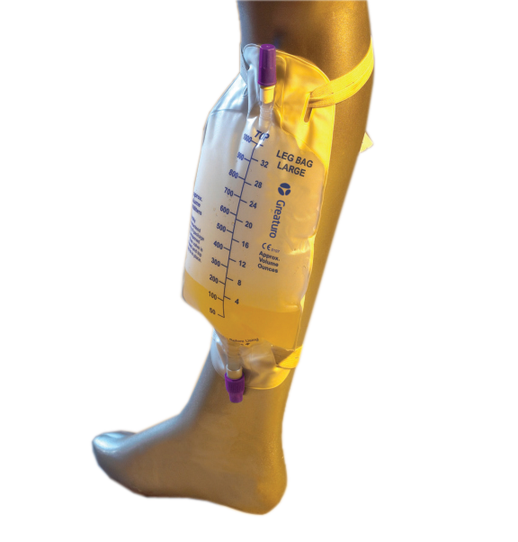 Endotracheal Tube, Cuffed